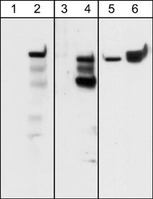 Phospho-CD104 Integrin beta 4 (Tyr1526) Antibody in Western Blot (WB)