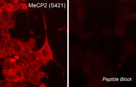 Phospho-MECP2 (Ser421) Antibody in Immunocytochemistry (ICC/IF)