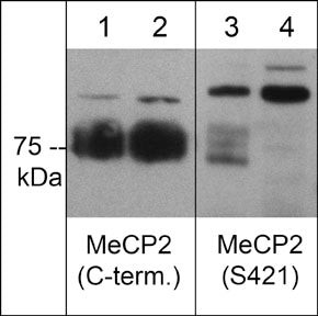 Phospho-MECP2 (Ser421) Antibody in Western Blot (WB)