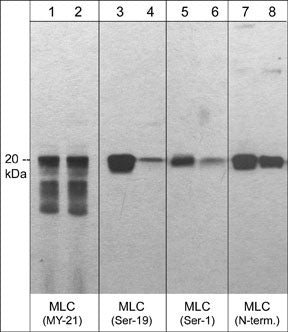 Phospho-MYL12A (Ser1) Antibody in Western Blot (WB)