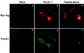 Plexin-A1 Antibody in Immunocytochemistry (ICC/IF)