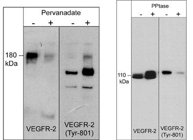 VEGF Receptor 2 Antibody in Western Blot (WB)