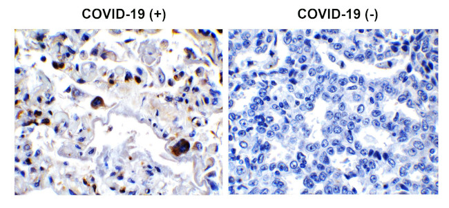 SARS 3CL Protease Antibody in Immunohistochemistry (Paraffin) (IHC (P))