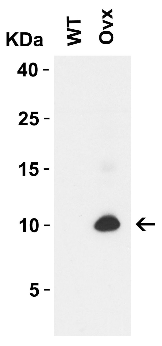 SARS-CoV-2 ORF9c Antibody in Western Blot (WB)