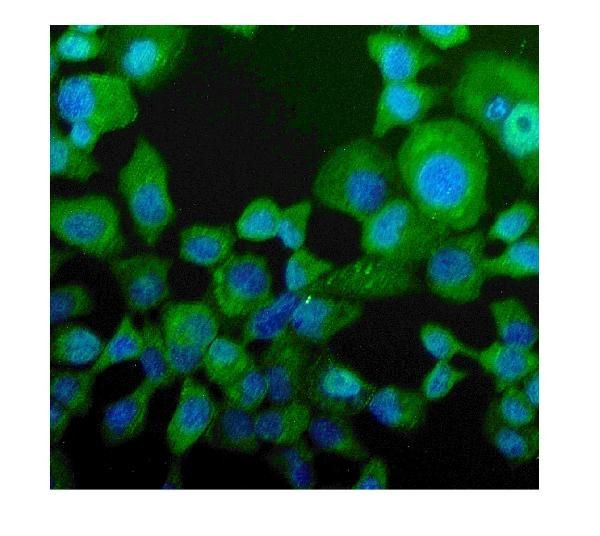 NPC2 Antibody in Immunocytochemistry (ICC/IF)