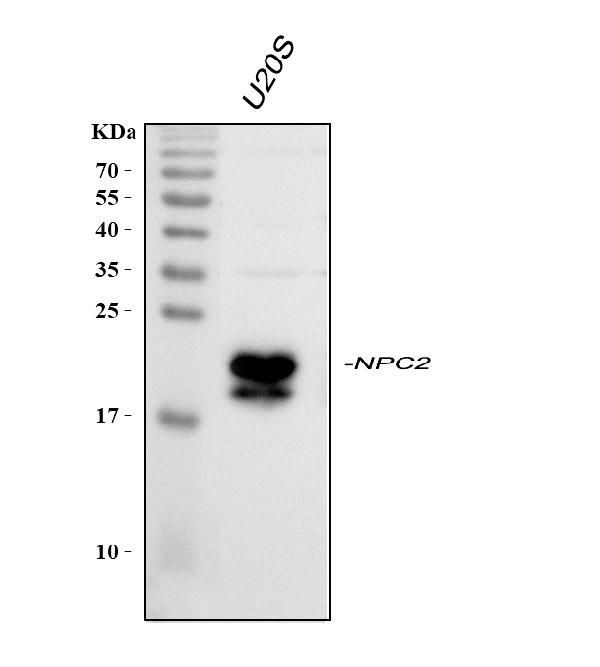 NPC2 Antibody in Western Blot (WB)