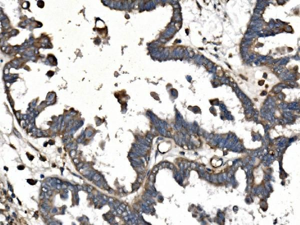 CALM Antibody in Immunohistochemistry (Paraffin) (IHC (P))