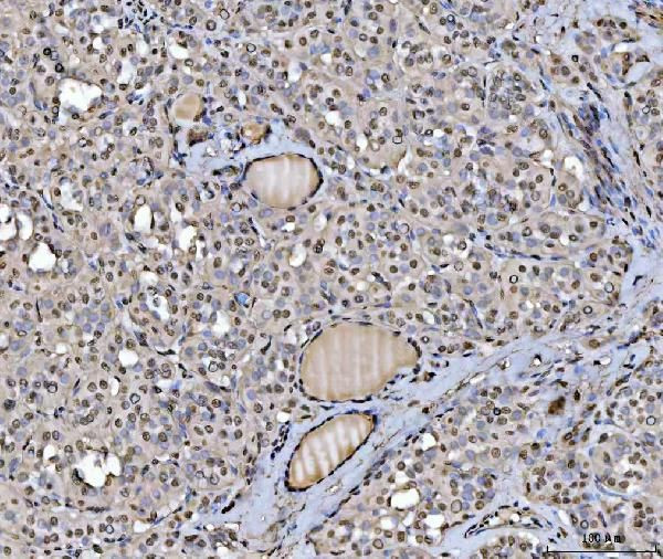 hnRNP U Antibody in Immunohistochemistry (Paraffin) (IHC (P))