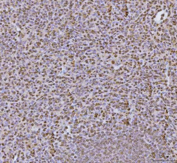 hnRNP U Antibody in Immunohistochemistry (Paraffin) (IHC (P))