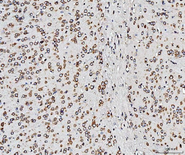 RPL10 Antibody in Immunohistochemistry (Paraffin) (IHC (P))