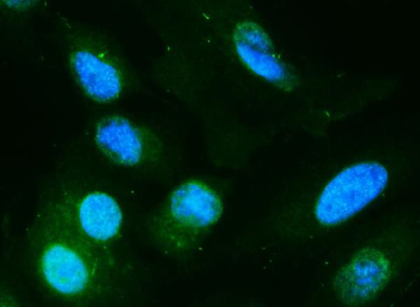 DIO1 Antibody in Immunocytochemistry (ICC/IF)