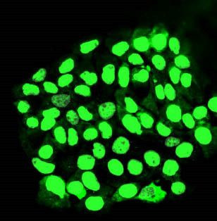 MORC3 Antibody in Immunocytochemistry (ICC/IF)