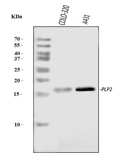PLP2 Antibody in Western Blot (WB)