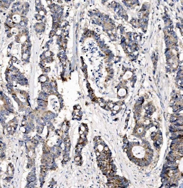 CHCHD10 Antibody in Immunohistochemistry (Paraffin) (IHC (P))