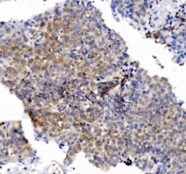 CHCHD10 Antibody in Immunohistochemistry (Paraffin) (IHC (P))