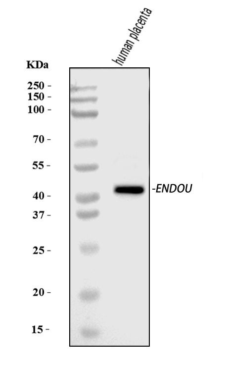 PP11 Antibody in Western Blot (WB)