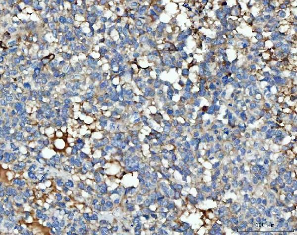 Thrombospondin 3 Antibody in Immunohistochemistry (Paraffin) (IHC (P))