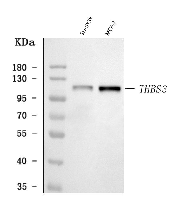 Thrombospondin 3 Antibody in Western Blot (WB)