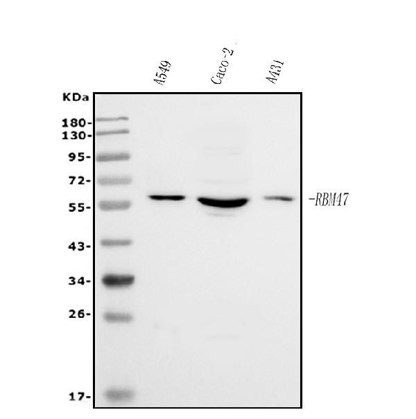 RBM47 Antibody in Western Blot (WB)