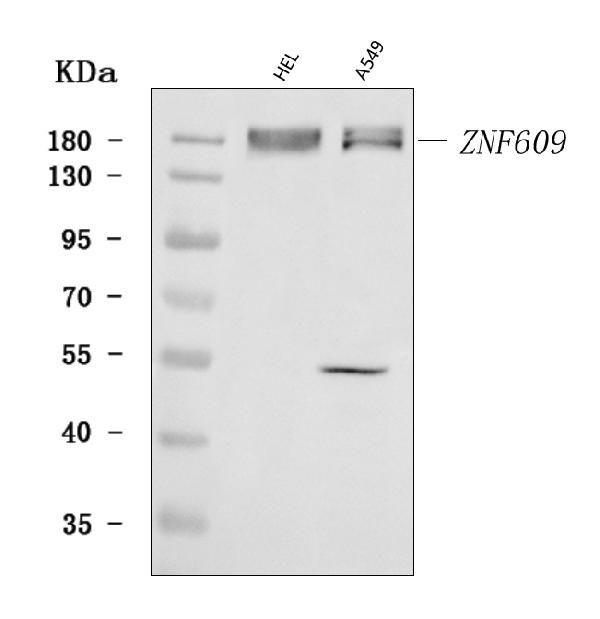 ZNF609 Antibody in Western Blot (WB)
