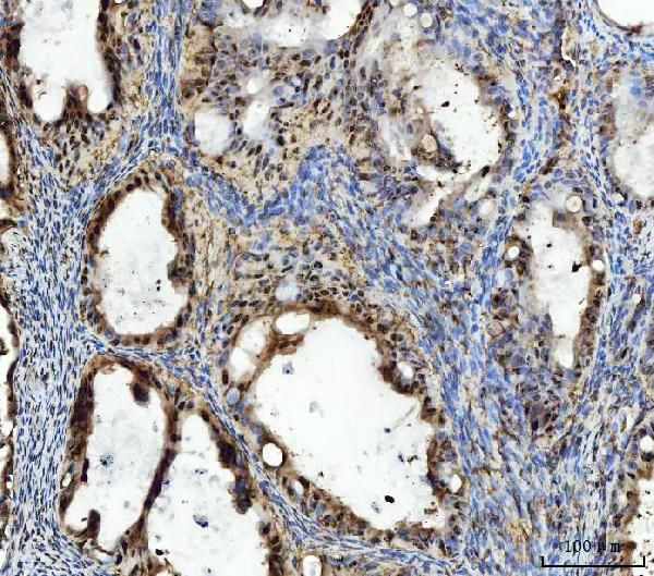 TIGD1 Antibody in Immunohistochemistry (Paraffin) (IHC (P))