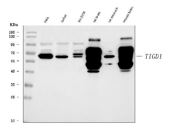 TIGD1 Antibody in Western Blot (WB)