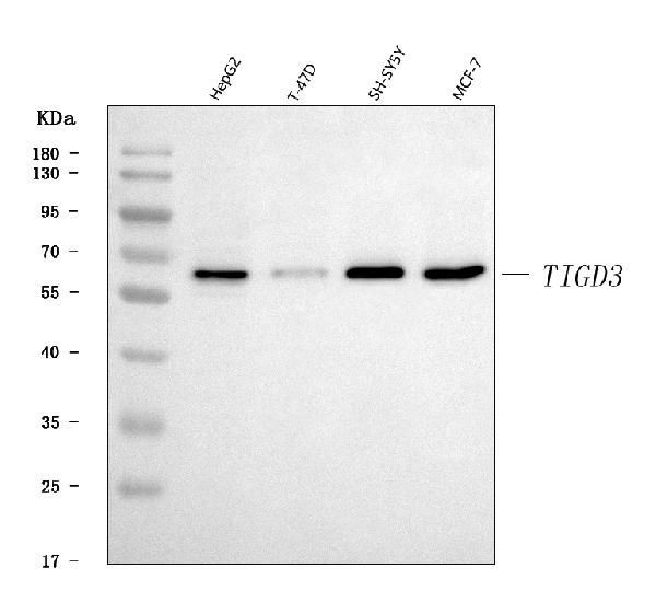 TIGD3 Antibody in Western Blot (WB)