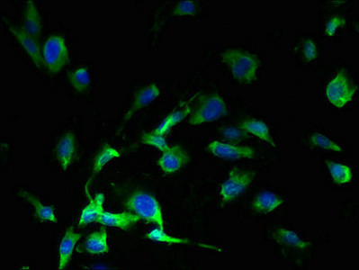 SLC38A7 Antibody in Immunocytochemistry (ICC/IF)