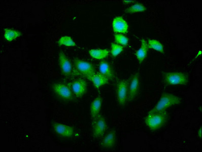 PIH1D1 Antibody in Immunocytochemistry (ICC/IF)