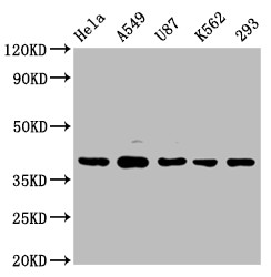 PIH1D1 Antibody in Western Blot (WB)