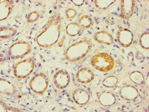 AES Antibody in Immunohistochemistry (Paraffin) (IHC (P))