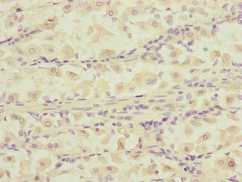 DCTN6 Antibody in Immunohistochemistry (Paraffin) (IHC (P))