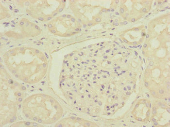 DCTN6 Antibody in Immunohistochemistry (Paraffin) (IHC (P))