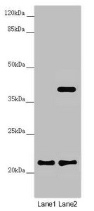 DCTN6 Antibody in Western Blot (WB)