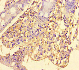 SRGAP2C Antibody in Immunohistochemistry (Paraffin) (IHC (P))