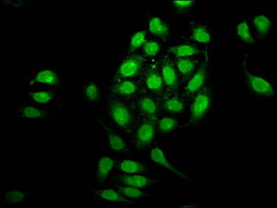 NUP98 Antibody in Immunocytochemistry (ICC/IF)