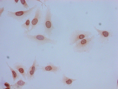 Acetyl-HIST1H2BB (Lys5) Antibody in Immunocytochemistry (ICC/IF)