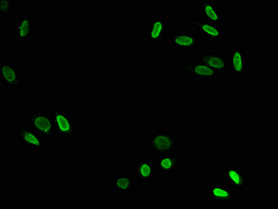 H3K79ac Antibody in Immunocytochemistry (ICC/IF)