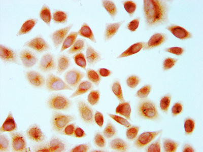 H4R67me1 Antibody in Immunocytochemistry (ICC/IF)