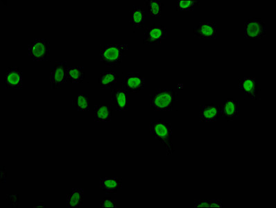 H4K79ac Antibody in Immunocytochemistry (ICC/IF)