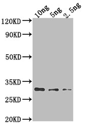 AADB Antibody in Western Blot (WB)