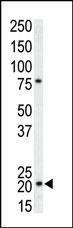 p21 Antibody in Western Blot (WB)