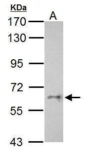 CYP26C1 Antibody in Western Blot (WB)