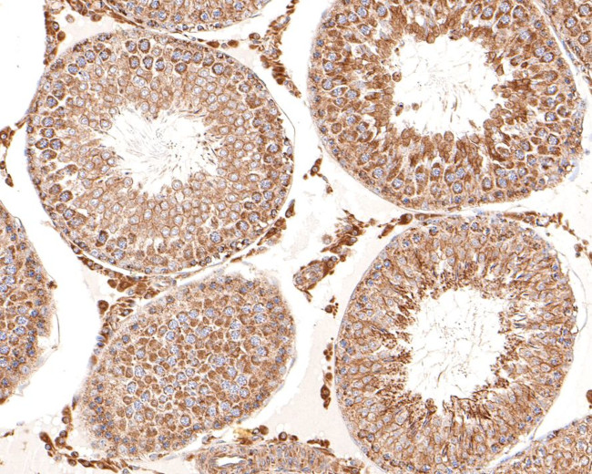 TIMM23 Antibody in Immunohistochemistry (Paraffin) (IHC (P))