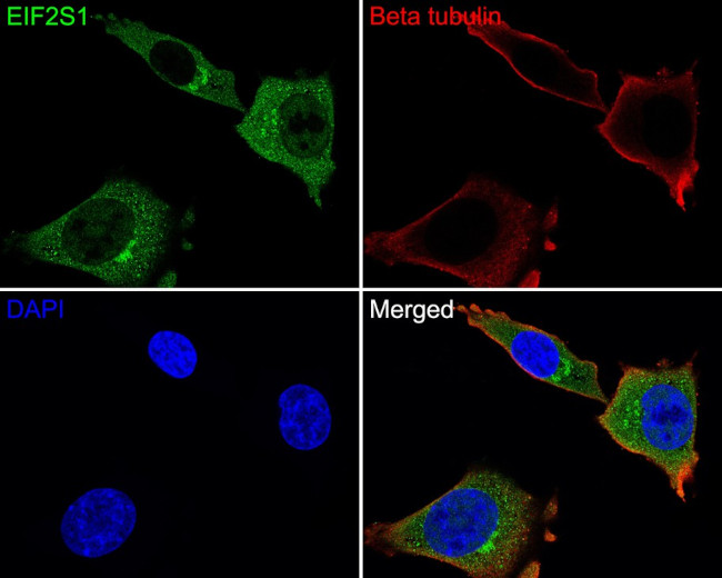 EIF2S1 Antibody in Immunocytochemistry (ICC/IF)