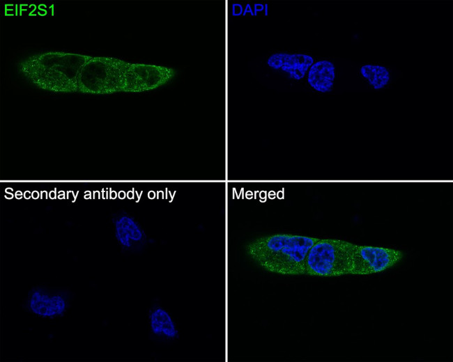 EIF2S1 Antibody in Immunocytochemistry (ICC/IF)