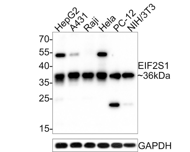 EIF2S1 Antibody in Western Blot (WB)