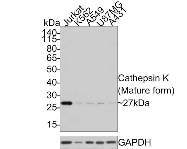 Cathepsin K Antibody in Western Blot (WB)