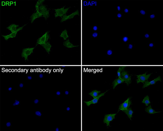 DNM1L Antibody in Immunocytochemistry (ICC/IF)
