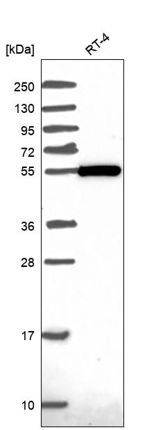 ZBTB46 Antibody in Western Blot (WB)